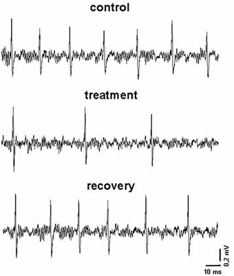 Brain Distribution and Modulation of Neuronal Excitability by Indicaxanthin From Opuntia Ficus Indica Administered at Nutritionally-Relevant Amounts